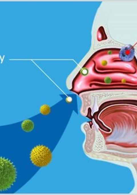VIÊM XOANG – VIÊM MŨI DỊ ỨNG