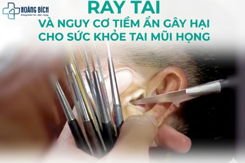 Thói Quen Lấy Ráy Tai Mỗi Ngày: Nguy Cơ Tiềm Ẩn Gây Nhiều Bệnh Về Tai